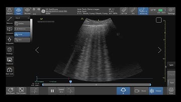 Venue Family Tutorials: Shock Toolkit