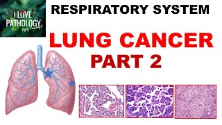 LUNG CANCER - Part 2- Morphology, Clinical features