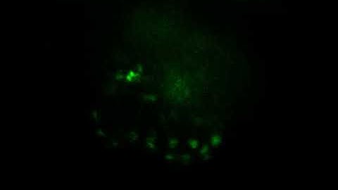 Live zebrafish epicardium imaged using light sheet microscopy