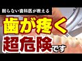 【虫歯治療を避けるために】歯が疼くがしばらくしたら治るという時は放置はダメ！歯周病や噛み合わせに問題あり！