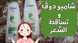 شامبو و بلسم دوف Dove و حل مشكلة تساقط الشعر