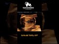 Corte TSVD y 3VT #ultrasound #ecografia #learning #cursosonline #obstetrician #fetalmedicine #feto