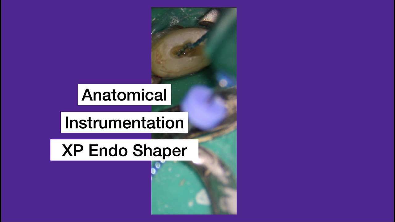 XP Endo Shaper, minimally invasive anatomical instrumentation YouTube