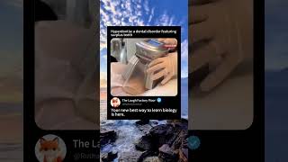 🥗Belly fat removal 🔪 with the help ❄️ of cryolipolysis 🧊| MDCT