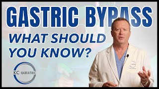 Gastric Bypass (RNY) - What Should You Know? | Bariatric FAQ Series