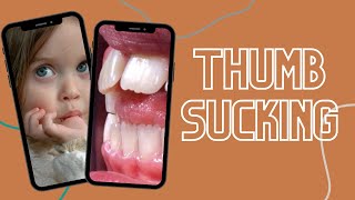 Thumbsucking #shorts