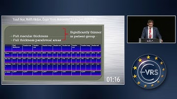 Retinal and Choroidal Vascular Changes in Macular Telangiectasia Type 2 on OCT Angiography