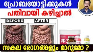 പ്രോബയോട്ടിക്കുകൾ  പതിവായി കഴിച്ചാൽ സകല രോഗങ്ങളും മാറുമോ ? New Information