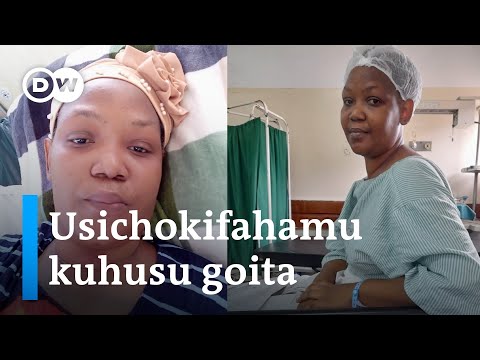 Video: Jinsi goiter inaweza kutibiwa?