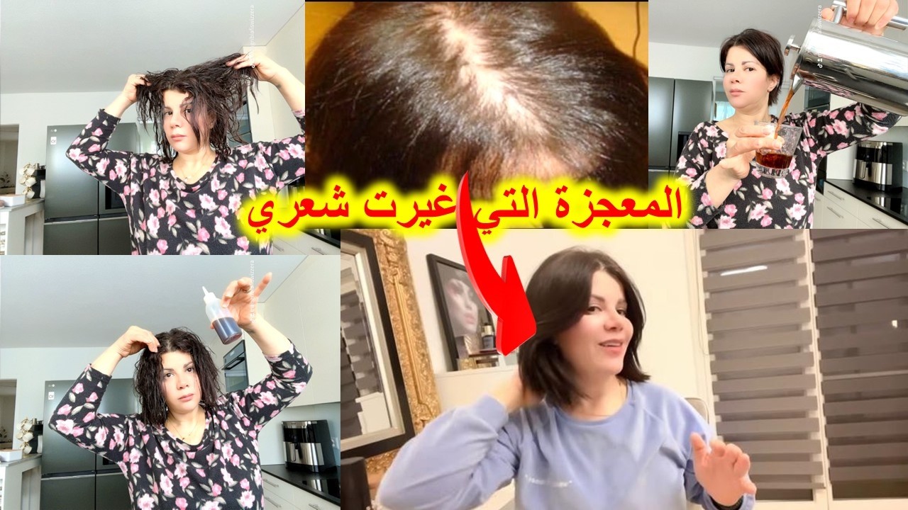 وداعا الفراغات والصلع وتساقط والنشوفية 💥غترحموا ليا الوالدين