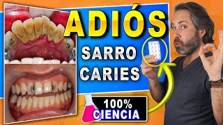 [ ] Para QUITAR el  de los dientes antes de que salga y  la   en CASA