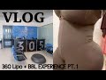 COME WITH ME TO GET 360 LIPO AND BBL SURGERY PT. 1 | 305 PLASTIC SURGERY |