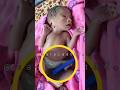 👶 Newborn's First Connection: The Umbilical Cord! 🩷#shorts #newborn #baby #virlshort#trendingshorts