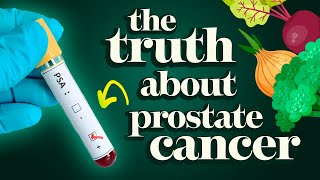 Why Are We Misled About Prostate Cancer? Dr. McDougall's Expert Guide to Beating Prostate Cancer