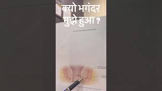 क्यों भगंदर मुझे ही हुआ है ? जाने कारण ? 7267925989 #piles #raebarely #ayurved #doctor
