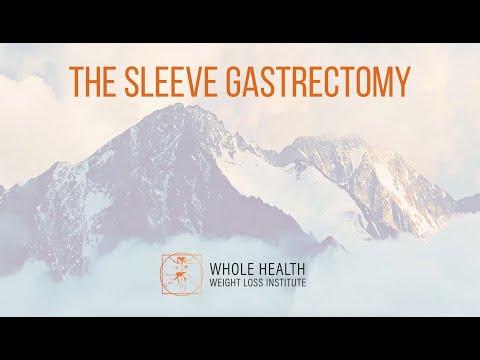 Sleeve Gastrectomy Surgery