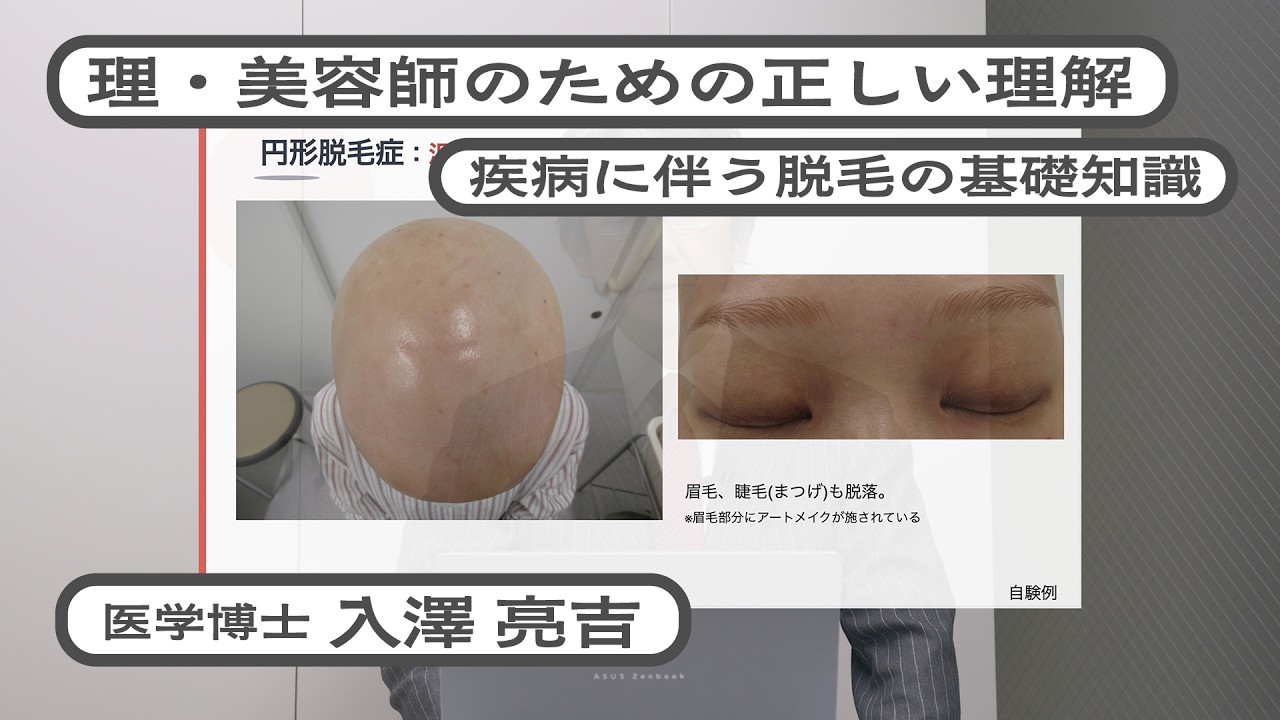 疾病に伴う脱毛への理解と美容師の役割/疾病に伴う脱毛の基礎知識