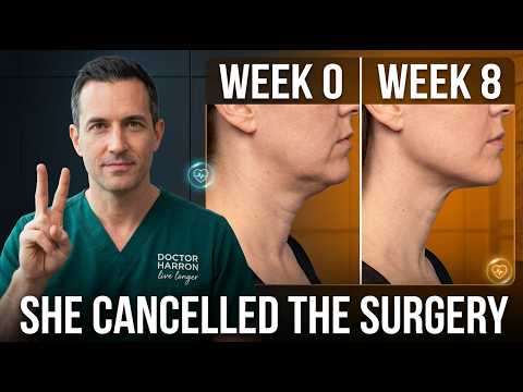 The 2-Minute NECK STRETCH That REPLACES Neck Lift Surgery (EXPLAINED IN 19 MINUTES)