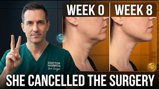 The 2-Minute NECK STRETCH That REPLACES Neck Lift Surgery (EXPLAINED IN 19 MINUTES)