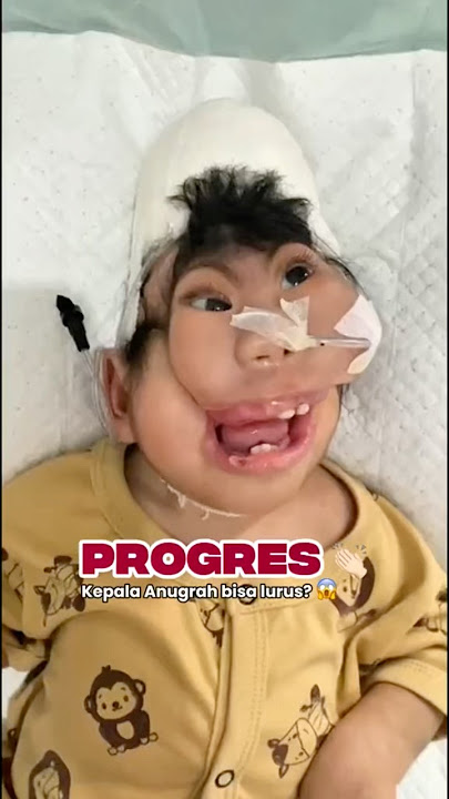 PROGRES ANUGRAH #anugraharshaka #anilestariofficial #foryou