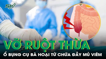 Vỡ ruột thừa suốt 10 ngày, ổ bụng cụ bà hoại tử chứa đầy mủ và dịch viêm | SKĐS