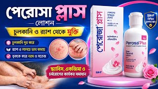 স্ক্যাবিস,খুজলি,খোঁসপাচড়া, চুলকানির সম্পূর্ণ চিকিৎসা | Perosa Plus Lotion | Scabies #স্ক্যাবিস