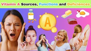 Vitamin A Sources, Functions, and Deficiencies Functions |Types of Vitamins A medical vitamin