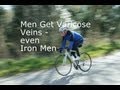 Varicose veins in men