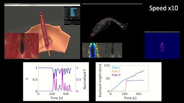 Girerd et al. 2020 : SLAM-based Follow-the-Leader Deployment of Concentric Tube Robots