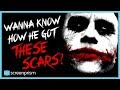 The Dark Knight: How Did the Joker Get His Scars?