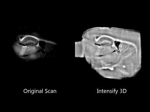 Intensify3D: Normalizing signal intensity in large heterogenic image stacks