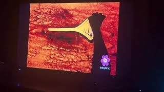 Babyfirst Sandman Episode 28 Guitar And Trumpet