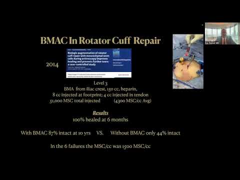 2024 Uses Of Stem Cells (Bone Marrow Aspirate Concentrate) in Sports Medicine