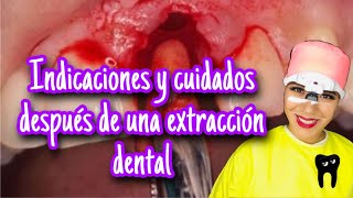 INDICACIONES Y CUIDADOS DESPUÉS DE UNA EXTRACCIÓN DENTAL