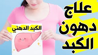 علاج الكبد الدهني في المنزل ( علاج دهون الكبد بالاعشاب الطبيعية )