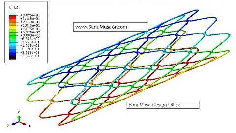 Stent Simulation Using UMAT/VUMAT Built-in Material Model in Abaqus