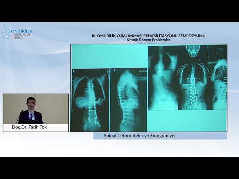 Doç.Dr. Fatih Tok / Spinal Deformiteler ve Siringomiyeli