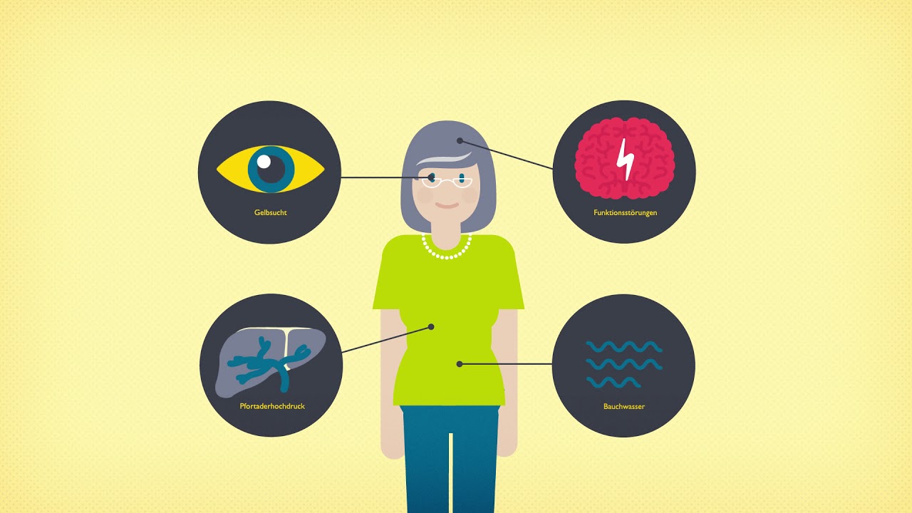 PBC einfach erklärt: Entstehung und Behandlung