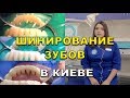 Шинирование зубов у стоматолога в Киеве (видео) - Люми-Дент (шинування зубів)