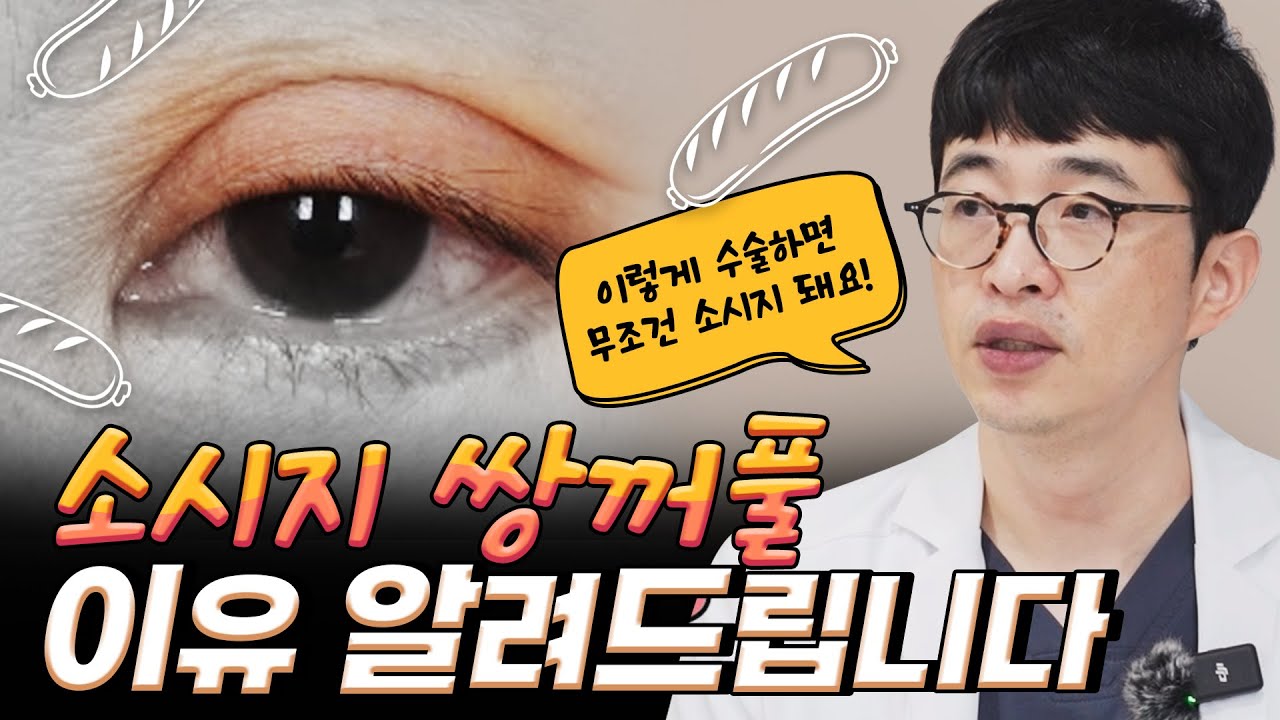 무조건 소시지 쌍꺼풀 만드는 수술법이 있었다?!?!