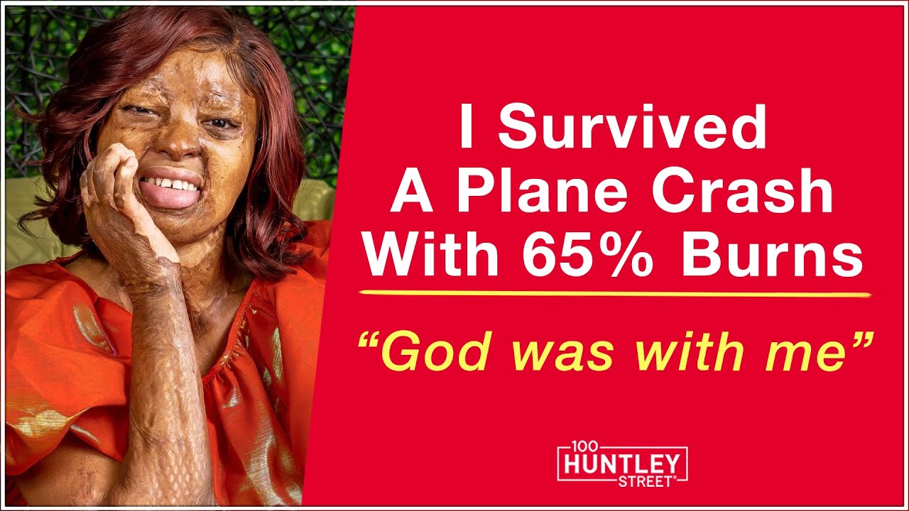 I Survived Plane Crash With 65% Burns - Kechi Okwuchi