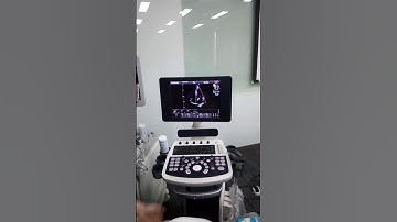 QBit5 Cardiac Image Introduction