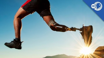 The Modern Prosthetic Limb: Where did it come from? | Stuff of Genius