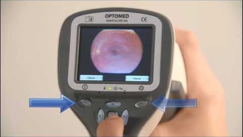 Smartscope PRO with EY4 - Extra tips for achieving good image quality