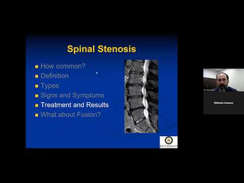 Lumbar Spinal Stenosis: Diagnosis and Treatment Options  – A Lecture from Dr. Christopher Kepler