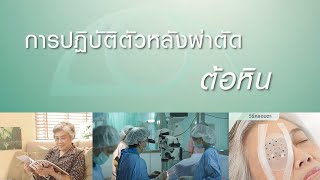 รพ.จักษุ รัตนิน - การปฏิบัติตัวหลังผ่าตัดต้อหิน