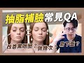 抽脂補臉常見QA 脂肪位移？補太多怎辦？黑眼圈能治療嗎｜周杰醫師