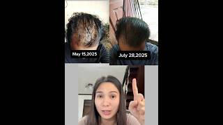 Eva’s Cloves Oil for Hair Growth, Hairloss, Hair Fall ( Salamat sa Feedback Sir ☺️) Grabe 😍