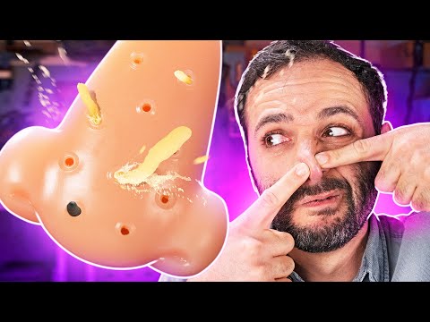 Vídeo: O que há de errado com o meu cravo?