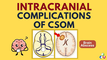 Intracranial Complications of Chronic Suppurative Otitis Media (CSOM) | Part 3